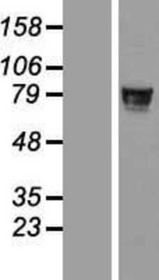 Western Blot: ZNF526 Overexpression Lysate [NBL1-18172]