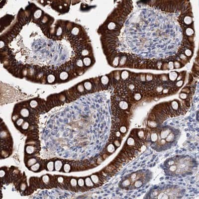 Immunohistochemistry-Paraffin: ZNF527 Antibody [NBP1-93572]