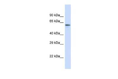 Western Blot: ZNF527 Antibody [NBP2-88707]