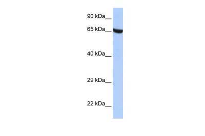 Western Blot: ZNF528 Antibody [NBP3-10389]