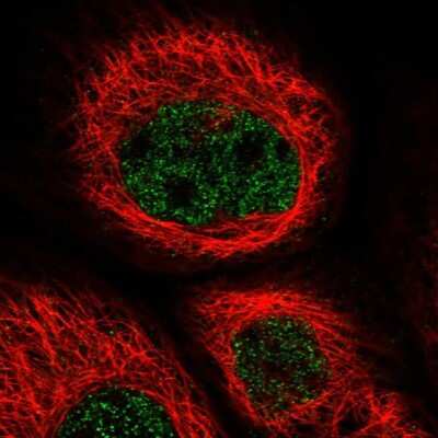 Immunocytochemistry/ Immunofluorescence: ZNF529 Antibody [NBP1-81396]