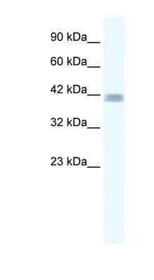 Western Blot: ZNF529 Antibody [NBP1-80121]