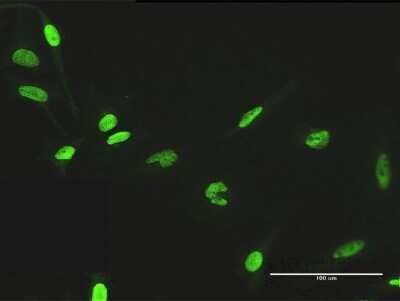 Immunocytochemistry/ Immunofluorescence: ZNF530 Antibody [H00348327-B01P]