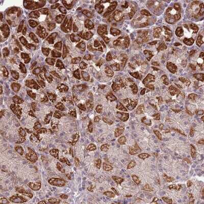 Immunohistochemistry-Paraffin: ZNF530 Antibody [NBP2-13580]