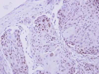 Immunohistochemistry-Paraffin: ZNF530 Antibody [NBP2-21023]