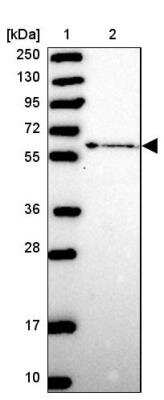 Western Blot: ZNF530 Antibody [NBP2-13580]