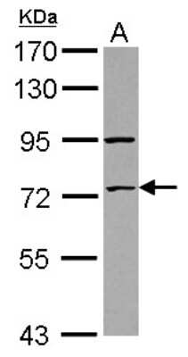 Western Blot: ZNF530 Antibody [NBP2-21023]