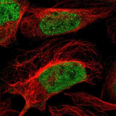 Immunocytochemistry/ Immunofluorescence: ZNF532 Antibody [NBP1-83838]