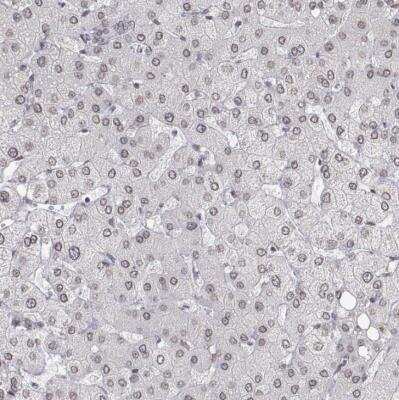 Immunohistochemistry-Paraffin: ZNF532 Antibody [NBP1-83838]