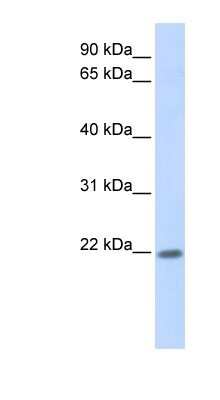 Western Blot: ZNF534 Antibody [NBP1-91546]