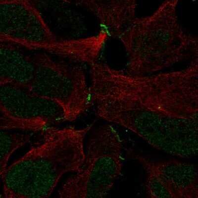 Immunocytochemistry/ Immunofluorescence: ZNF536 Antibody [NBP2-69034]