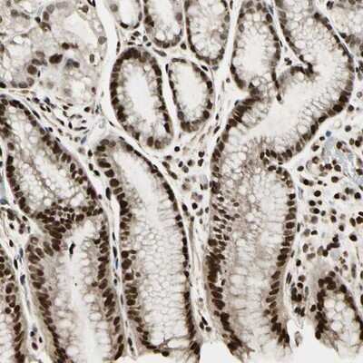 Immunohistochemistry-Paraffin: ZNF537 Antibody [NBP1-92629]
