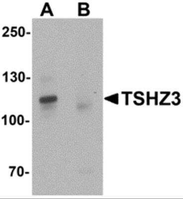 Western Blot: ZNF537 AntibodyBSA Free [NBP2-81880]