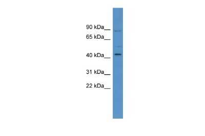 Western Blot: ZNF540 Antibody [NBP2-83866]