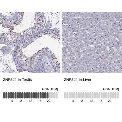 Immunohistochemistry-Paraffin: ZNF541 Antibody [NBP2-62706]