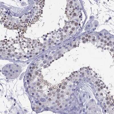 Immunohistochemistry-Paraffin: ZNF541 Antibody [NBP2-62706]