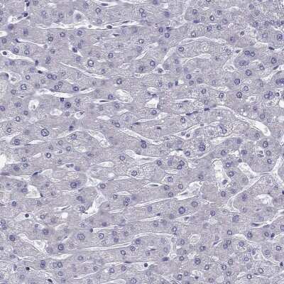 Immunohistochemistry-Paraffin: ZNF541 Antibody [NBP2-62706]