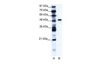 Western Blot: ZNF541 Antibody [NBP2-86510]