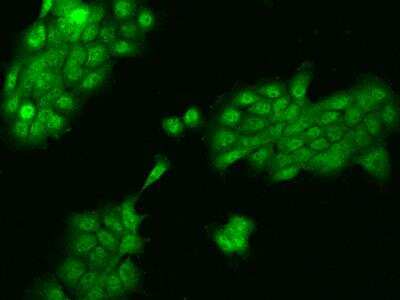 Immunocytochemistry/ Immunofluorescence: ZNF543 Antibody [NBP3-06246]