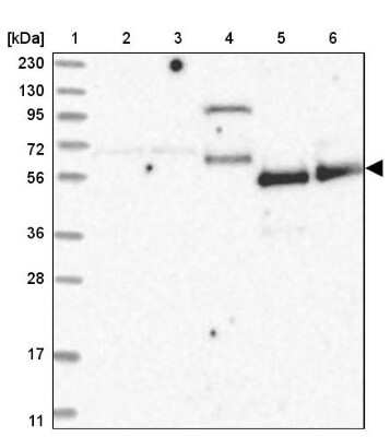 Western Blot: ZNF543 Antibody [NBP1-85122]