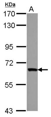 Western Blot: ZNF543 Antibody [NBP2-21024]