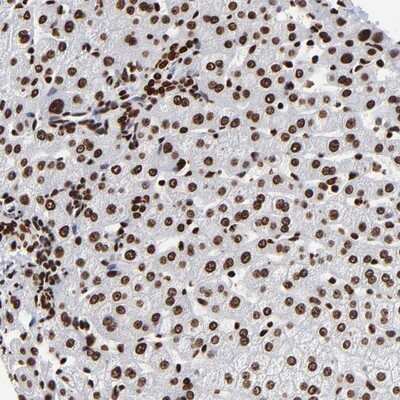 Immunohistochemistry-Paraffin: ZNF544 Antibody [NBP1-89224]