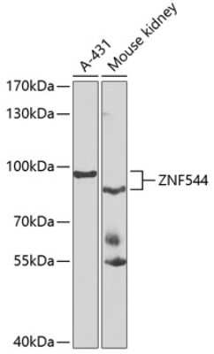 Western Blot: ZNF544 AntibodyBSA Free [NBP2-93611]