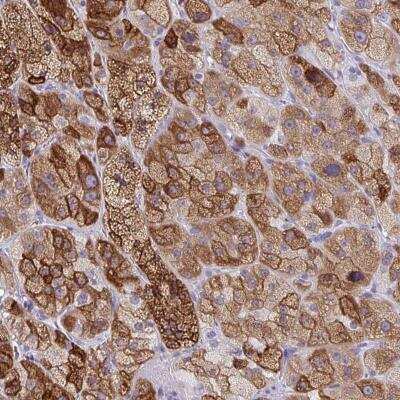 Immunohistochemistry-Paraffin: ZNF545 Antibody [NBP2-31823]