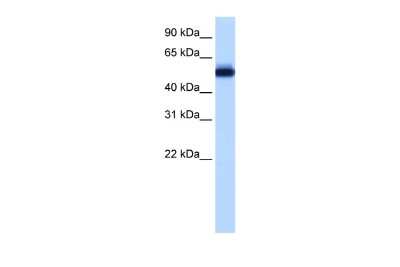 Western Blot: ZNF545 Antibody [NBP2-86512]