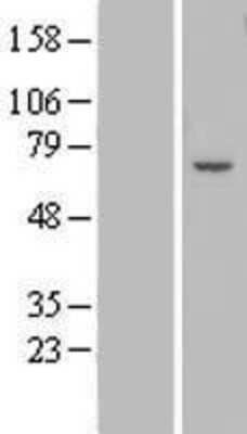 Western Blot: ZNF545 Overexpression Lysate [NBL1-18023]