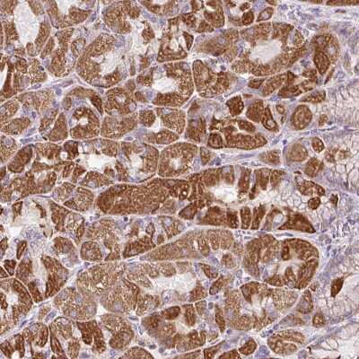 Immunohistochemistry: ZNF547 Antibody [NBP2-49208]