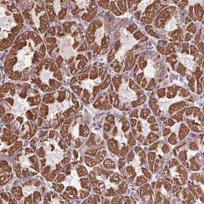 Immunohistochemistry: ZNF548 Antibody [NBP2-39065]