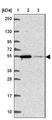 Western Blot: ZNF548 Antibody [NBP2-39065]