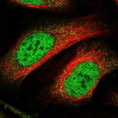 Immunocytochemistry/ Immunofluorescence: ZNF549 Antibody [NBP1-81970]