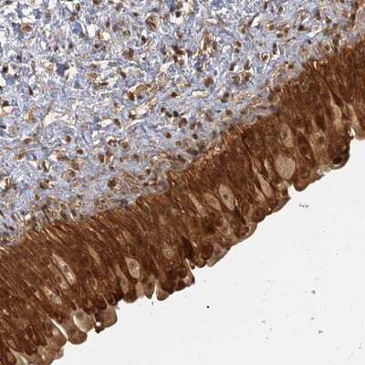 Immunohistochemistry-Paraffin: ZNF549 Antibody [NBP1-81970]