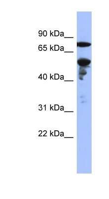 Western Blot: ZNF549 Antibody [NBP1-80425]