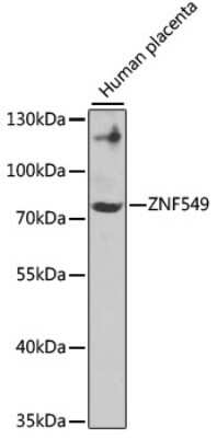 Western Blot: ZNF549 AntibodyBSA Free [NBP2-93078]