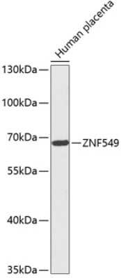 Western Blot: ZNF549 AntibodyBSA Free [NBP3-04628]