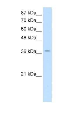 Western Blot: ZNF550 Antibody [NBP1-80424]