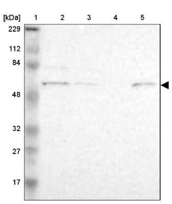 Western Blot: ZNF550 Antibody [NBP1-86158]