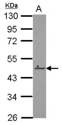 Western Blot: ZNF550 Antibody [NBP2-21025]