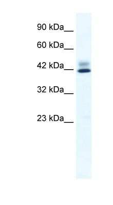 Western Blot: ZNF551 Antibody [NBP1-80139]