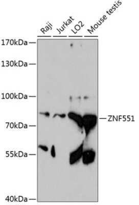 Western Blot: ZNF551 AntibodyAzide and BSA Free [NBP2-94652]