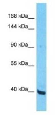 Western Blot: ZNF552 Antibody [NBP3-09925]