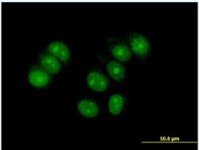 Immunocytochemistry/ Immunofluorescence: ZNF554 Antibody [H00115196-B01P-50ug]