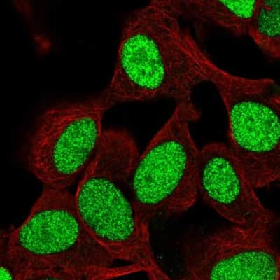 Immunocytochemistry/ Immunofluorescence: ZNF554 Antibody [NBP2-32519]