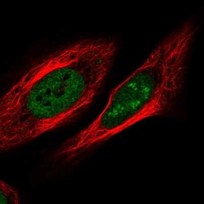 Immunocytochemistry/ Immunofluorescence: ZNF554 Antibody [NBP2-55914]