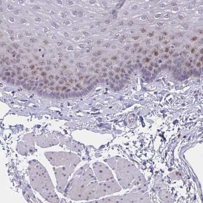 Immunohistochemistry-Paraffin: ZNF554 Antibody [NBP2-32519]