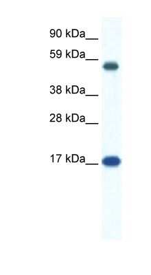 Western Blot: ZNF554 Antibody [NBP1-80149]