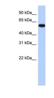 Western Blot: ZNF554 Antibody [NBP1-80401]